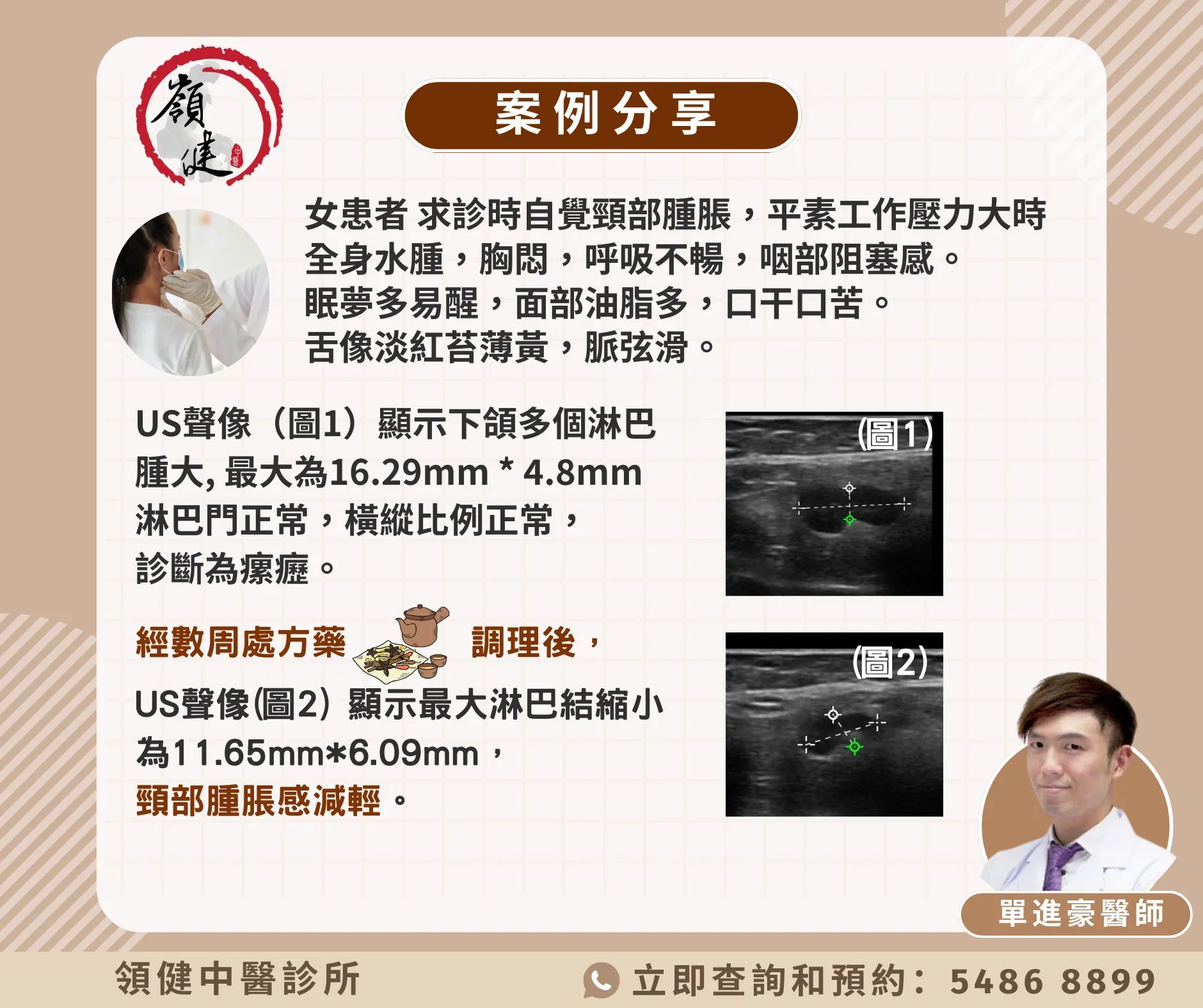 案例分享 — 超聲波對比